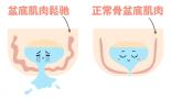 男人状态变差，一直被忽略的盆底才是衰老元凶